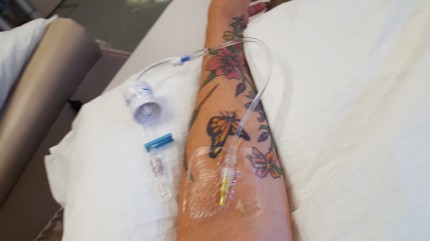 Getting my infusion this morning...hoping it helps me. I have severe Rhumotoid Arthritis. Dietbet h
