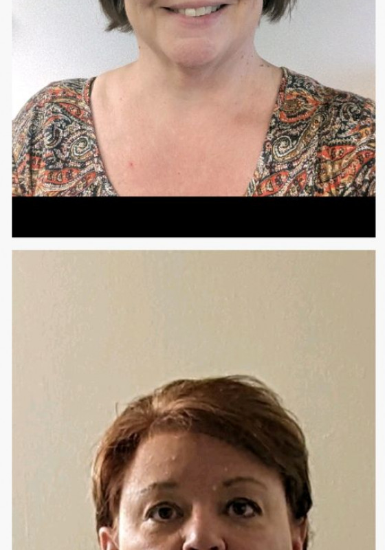 Difference between Day 1 and today.