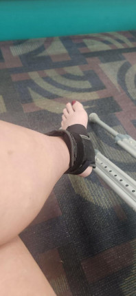 After a bad ankle break and 9 weeks on crutches, I just got the go ahead from my doctor to start wal